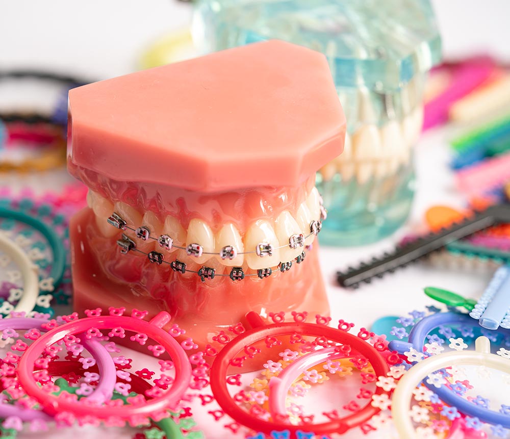 New Patients Welcome - Hometown Orthodontics - Orthodontic Specialists Beaumont