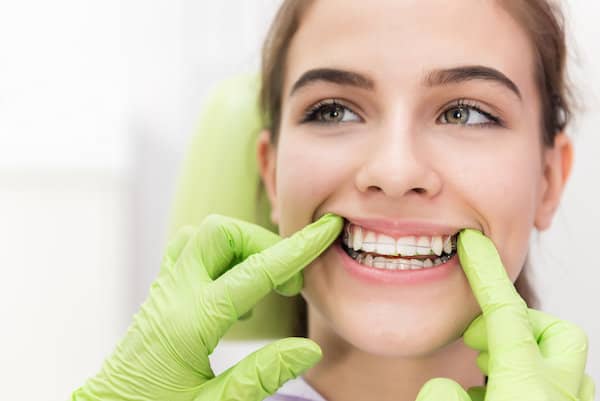 Two Phase Treatment Beaumont Hometown Orthodontics